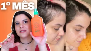 Tônico Poderoso Gold Spell: Adeus Queda de Cabelo e Falhas 🧪