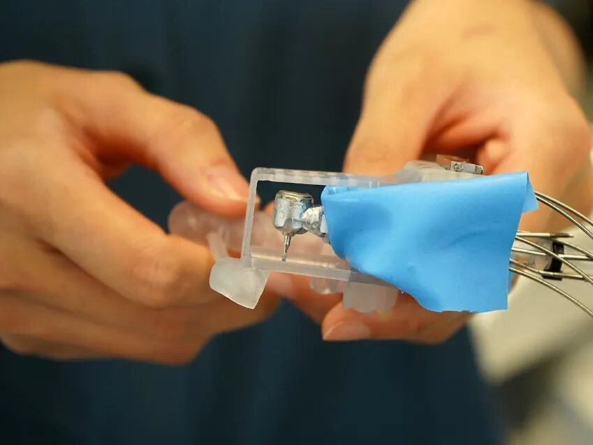 Robô MIR promete coroas dentárias em única sessão: vale o investimento? - Imagem do artigo original