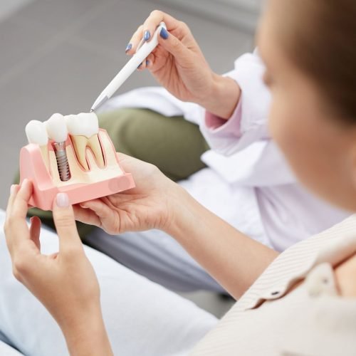 Implante dentário: saiba escolher o dentista certo e evitar erros caros