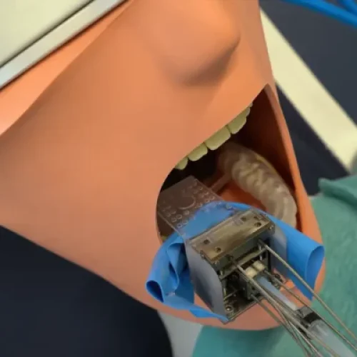 Robô MIR promete coroas dentárias em única sessão: vale o investimento?